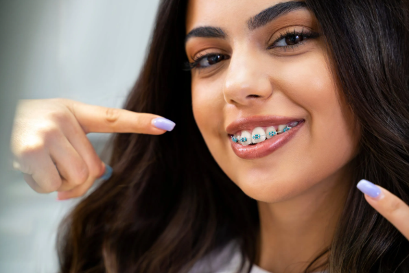 Why Adult Orthodontics Is More Popular Than Ever