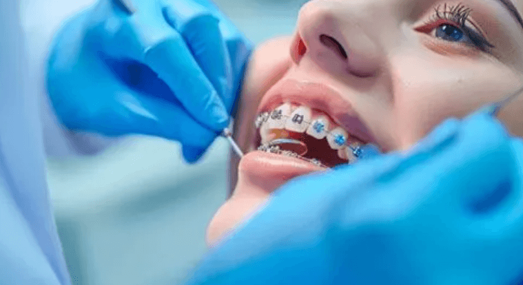 Why Orthodontic Services Are Becoming More Accessible