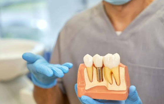 3 Advantages Of Visiting A Specialist For Implant Dentistry