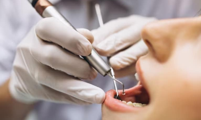 Endodontics and the Importance of Preserving Natural Teeth